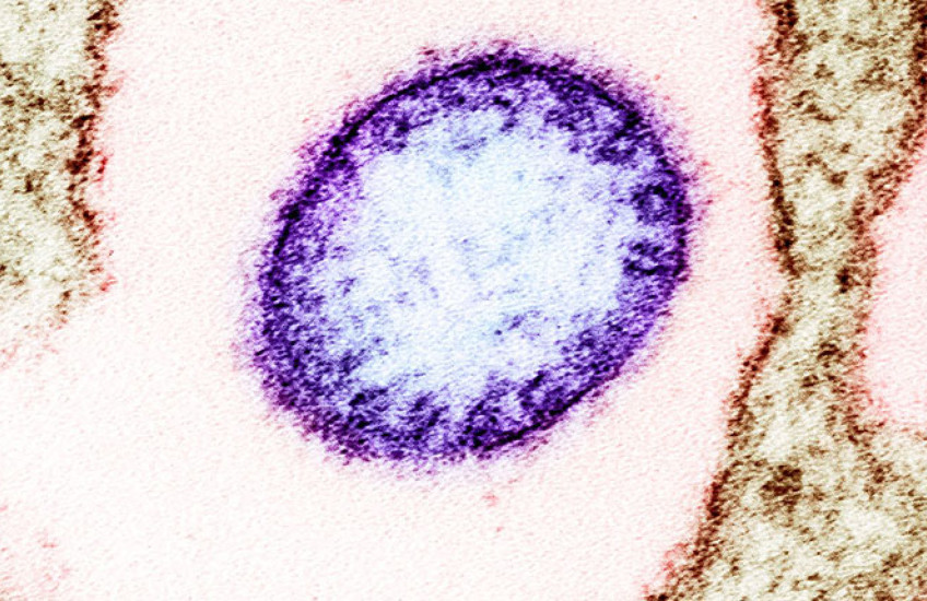 nipah virus