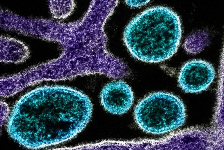 que es el virus nipah