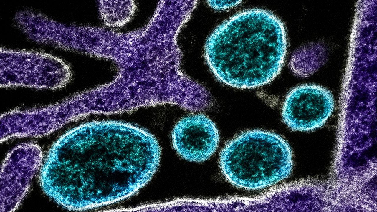 que es el virus nipah